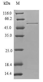 Human TPM4 protein