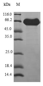 Human ATP6V0D1 protein
