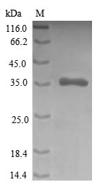 Human CRIP1 protein