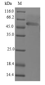 Human LDB3 protein