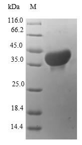 Human S100A14 protein