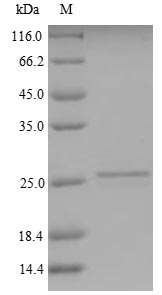 Human CT83 protein