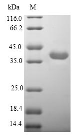 Human CHRNA3 protein