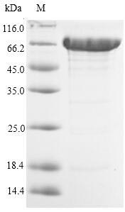 Human ACSS1 protein
