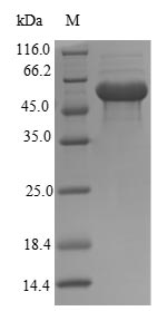 Mouse Txnip protein