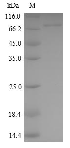 human KEAP1 protein