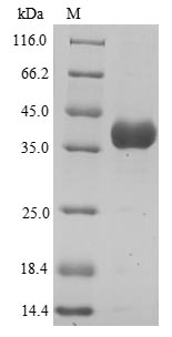 Human Annexin A3 protein