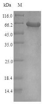 human KCNJ10 protein