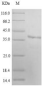 human MARCH2 protein