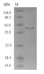 Human APH1a protein