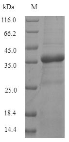 Human TMEM65 protein