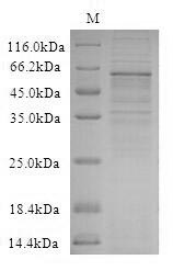 Human WNT2B protein