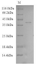 Human CSE1L protein