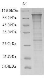 Human RFWD2 protein
