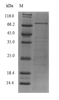 Human REXO4 protein