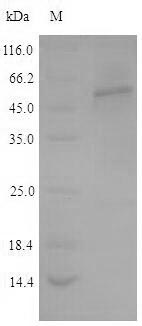 Human TPH2 protein