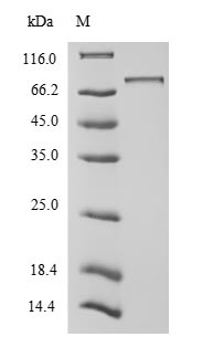 Human UBTF protein