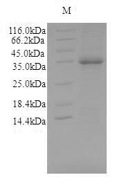 Mouse Asah1 protein