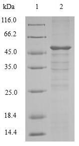 Mouse Setd4 protein