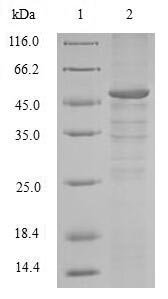 Human CCNB1 protein