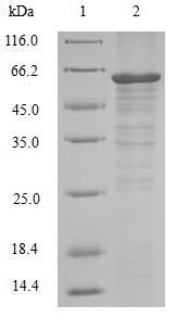 Human RIPK3 protein