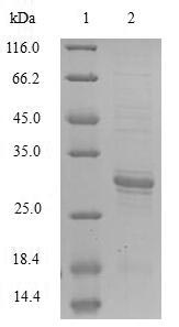 E. coli yjeE protein