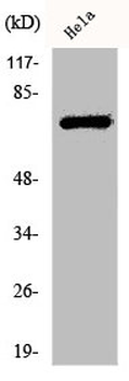 LIMK1/LIMK2 Antibody