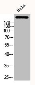 ACACA Antibody
