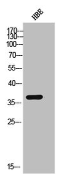 CSNK1A1/CSNK1A1L Antibody