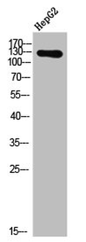 EPHA2/EPHA3/EPHA4 Antibody