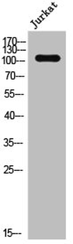 EPHA2/EPHA5 Antibody