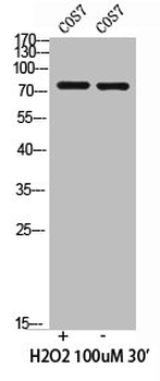 PIK3R1/PIK3R3 Antibody