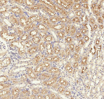 TGFBR1 Antibody