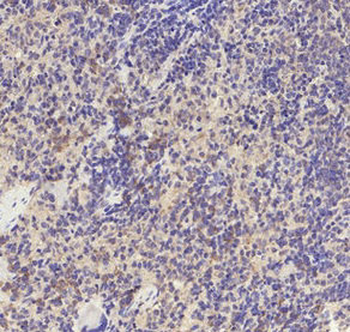TGFBR1 Antibody