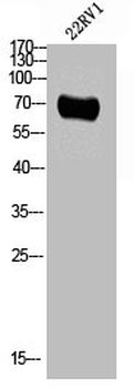 CAMK2B/CAMK2G/CAMK2D Antibody