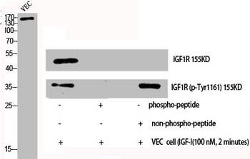 IGF1R/INSR Antibody