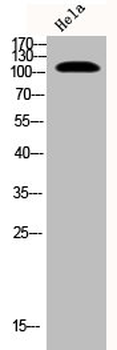 EPHB1/EPHB2 Antibody