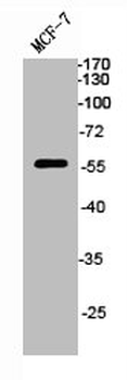 AKT1 Antibody