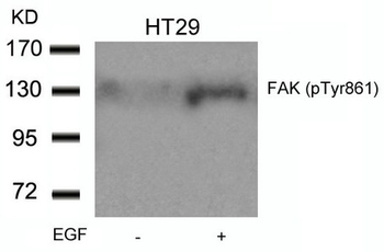 PTK2 Antibody