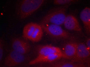 TH Antibody