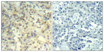 CFL1 Antibody