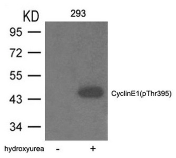 CCNE1 Antibody