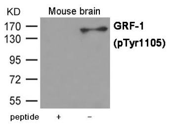ARHGAP35 Antibody