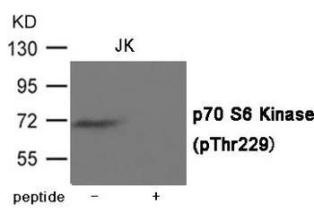 RPS6KB1 Antibody