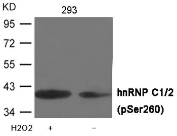 HNRNPC Antibody