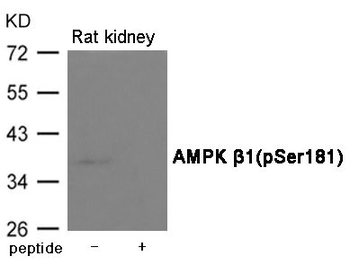 PRKAB1 Antibody