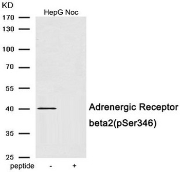 ADRB2 Antibody