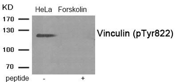 VCL Antibody