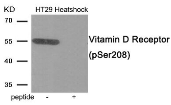 VDR Antibody