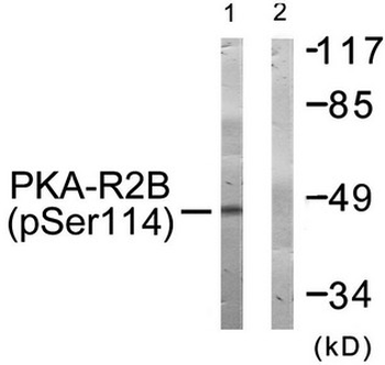 PRKAR2B Antibody